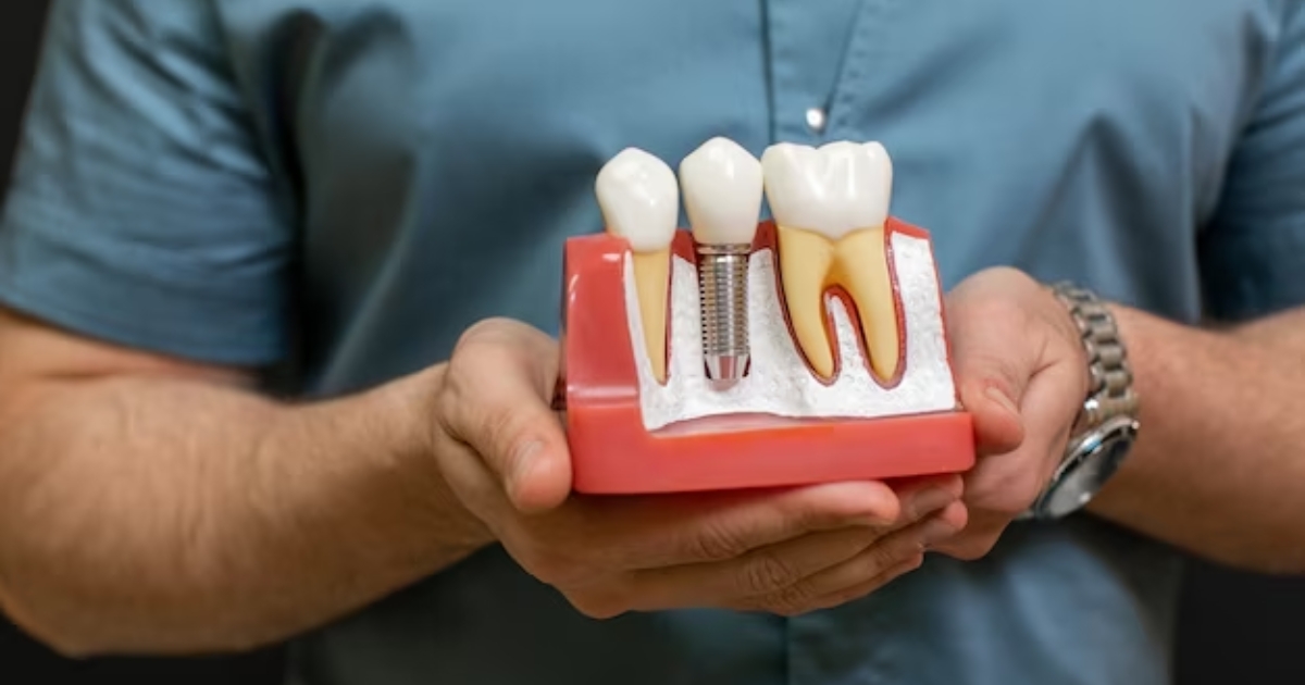 Same Day Dental Implants Is it Possible to Get Teeth in One Day