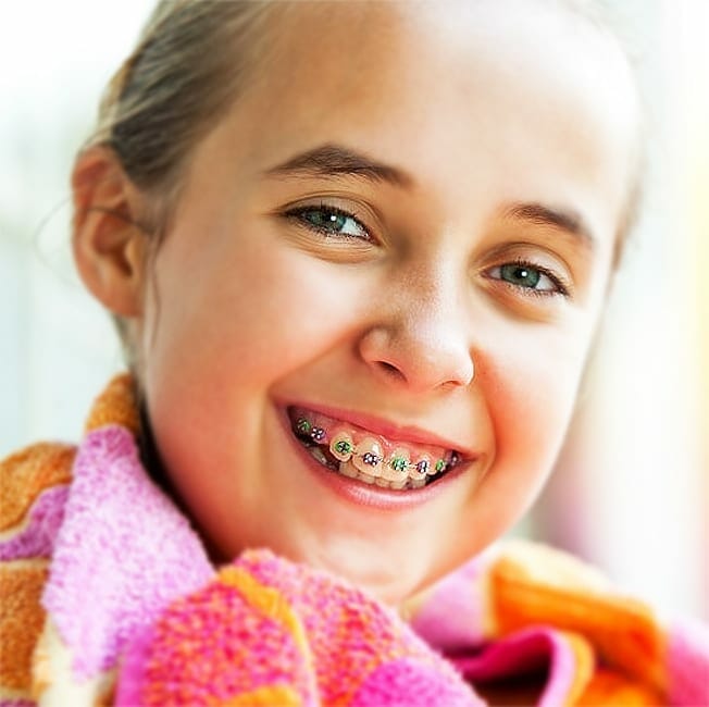 child-orthodontics braces springfield