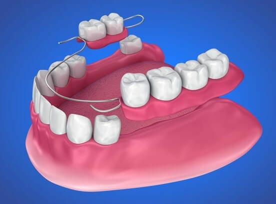 partial dentures springfield