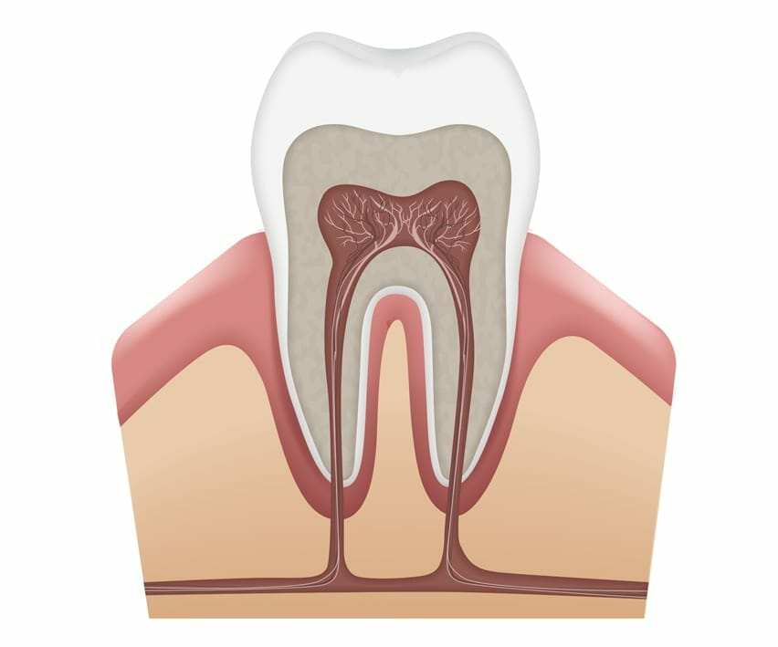 root canal treatment springfield