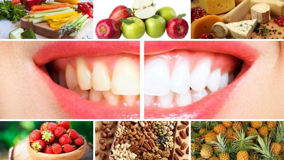 foods for teeth whitening to enjoy this Thanksgiving