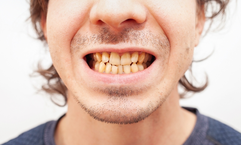 dental health in springfield