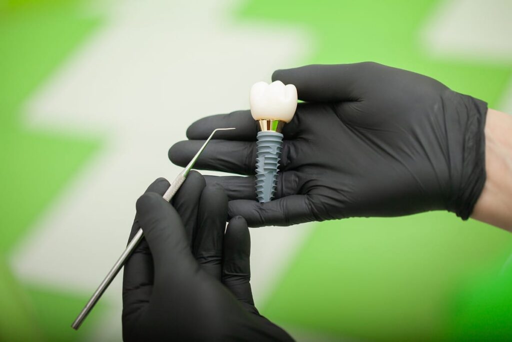 All-on-4 Dental Implants in Springfield