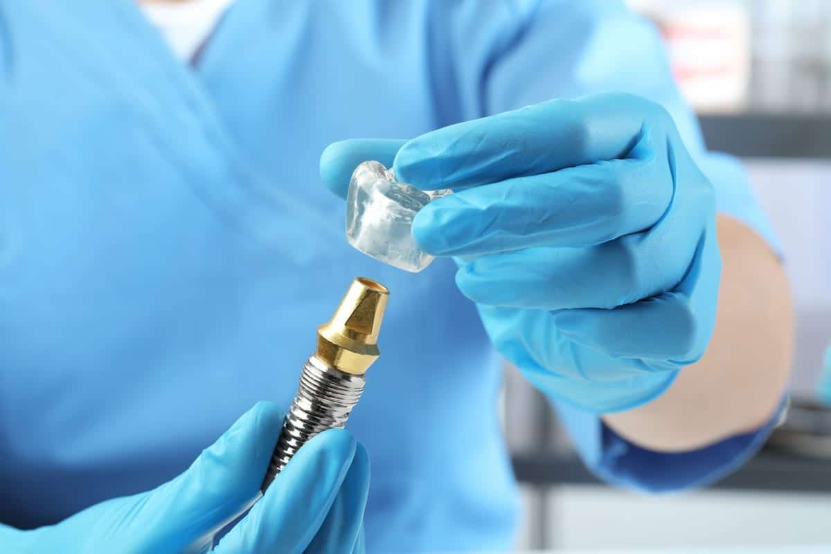 Dental Implant Recovery in Springfield
