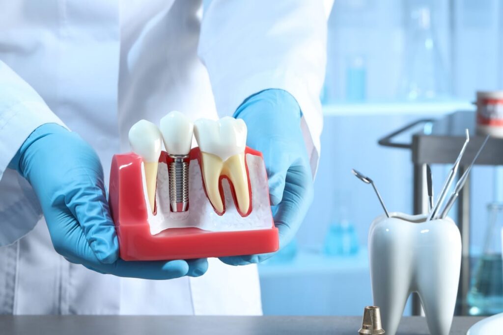Implant Supported Dentures in Springfield